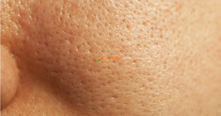 xxx
