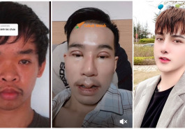ft surgery