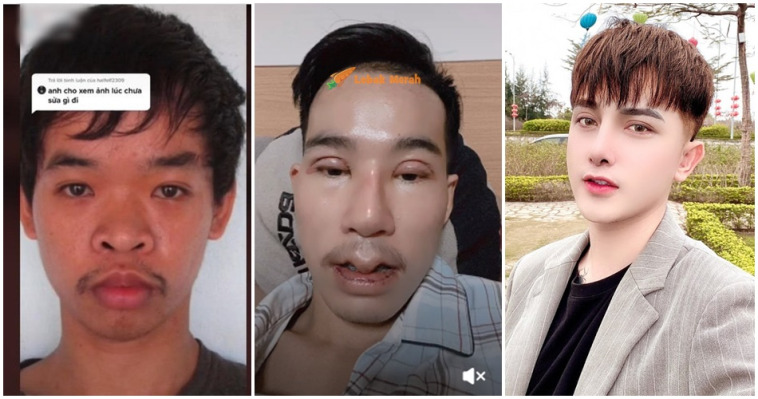 ft surgery