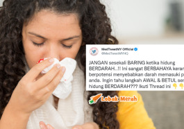 hidung berdarah