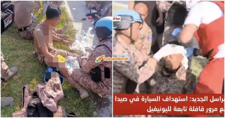 anggota MALBATT cedera di lubnan