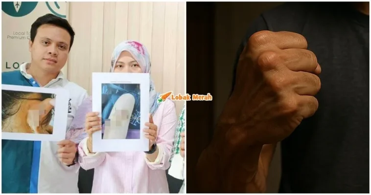 ft wanita dipukul