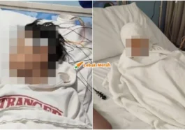 murid kanser hidung jadi mangsa buli