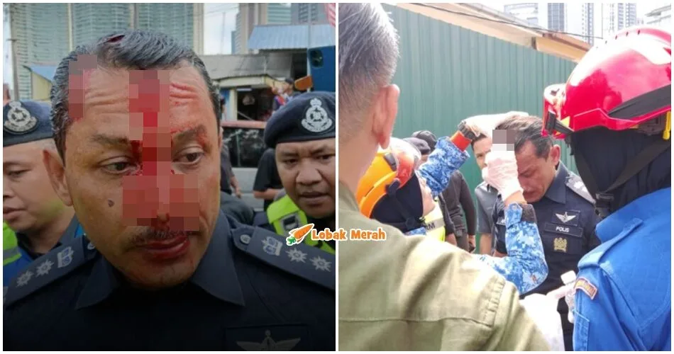 ft ketua polis dang wangi cedera