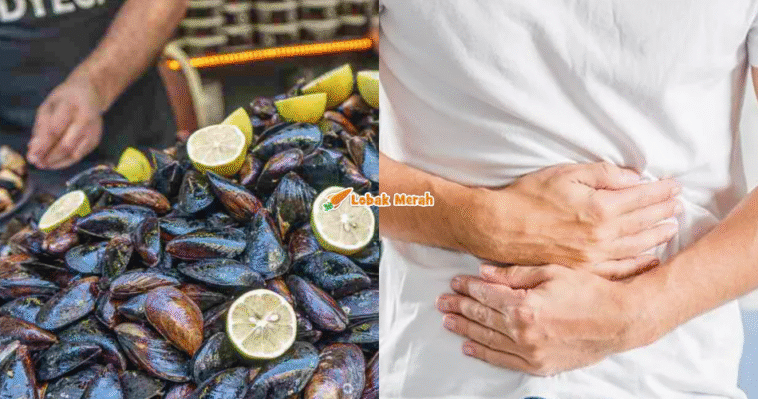 Keracunan Makanan